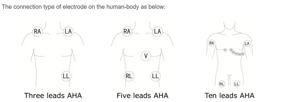 EKG vodiči s 5 vodiča za Philips digitrak plus 24-satni holter 3100A, 5-olovni, Snap