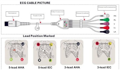 Kako pravilno spojiti EKG kabel sa žicama odvoda na monitor pacijenta?